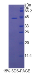 巨噬细胞炎性蛋白1β(MIP1β)重组蛋白