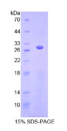 心肌肌动蛋白α1(ACTC1)重组蛋白