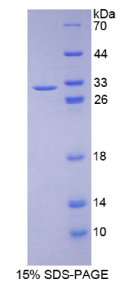 失调蛋白1(ATXN1)重组蛋白