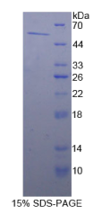 醛脱氢酶7家族成员A1(ALDH7A1)重组蛋白
