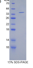 淋巴细胞功能关联抗原1α(LFA1α)重组蛋白