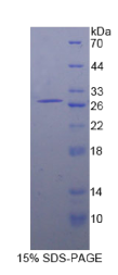 信号淋巴细胞激活分子家族成员5(SLAMF5)重组蛋白