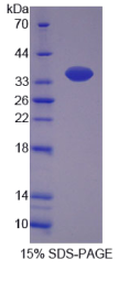 肾损伤分子1(Kim1)重组蛋白