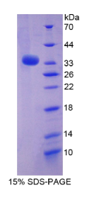 信号转导衔接分子1(STAM1)重组蛋白
