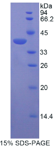 矢车菊苷α2(CENTα2)重组蛋白