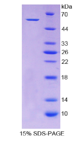 醛脱氢酶7家族成员A1(ALDH7A1)重组蛋白