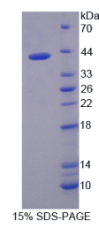 干扰素调节因子5(IRF5)重组蛋白