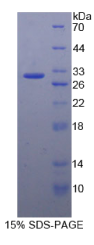 失调蛋白1(ATXN1)重组蛋白