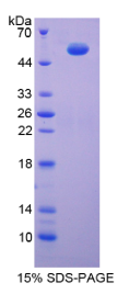 氢离子转运ATP酶线粒体F1复合体β肽(ATP5β)重组蛋白