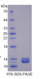 三叶因子1(TFF1)重组蛋白