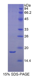 视黄醇结合蛋白2(RBP2)重组蛋白