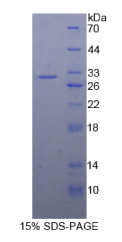信号传导转录激活因子2(STAT2)重组蛋白