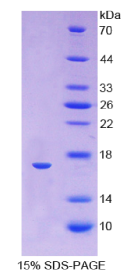 血红蛋白α1(HBα1)重组蛋白