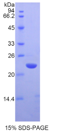 染色框同源物3(CBX3)重组蛋白