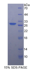 酪蛋白激酶1α1(CSNK1α1)重组蛋白