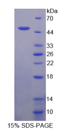 肽酶抑制因子16(PI16)重组蛋白