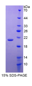 生长分化因子2(GDF2)重组蛋白