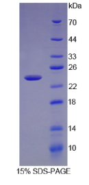 趋化因子C-X-C-基元配体15(CXCL15)重组蛋白