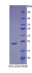 视黄醇结合蛋白1(RBP1)重组蛋白