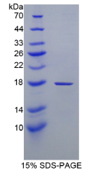 视黄醇结合蛋白1(RBP1)重组蛋白