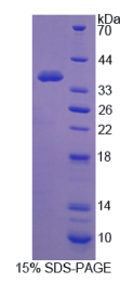 糖原合酶激酶3α(GSK3α)重组蛋白