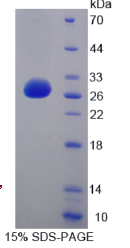 溶血磷脂酶Ⅰ(LYPLA1)重组蛋白