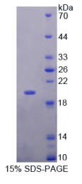 肌球蛋白轻链6(MYL6)重组蛋白