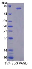 神经细胞黏附分子2(NCAM2)重组蛋白