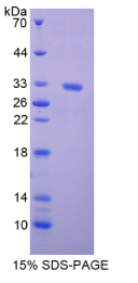 驱动蛋白家族成员5B(KIF5B)重组蛋白