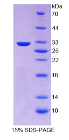 前蛋白转化酶枯草溶菌素1(PCSK1)重组蛋白