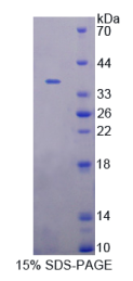 信号转导衔接分子1(STAM1)重组蛋白