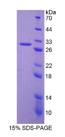 嗜中性粒细胞胞浆因子4(NCF4)重组蛋白