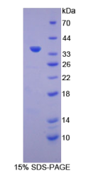 氢离子转运ATP酶溶酶体辅助蛋白2(ATP6AP2)重组蛋白