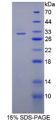 失调蛋白2结合蛋白1(A2BP1)重组蛋白