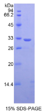 信号传导转录激活因子1(STAT1)重组蛋白