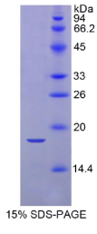 视黄醇结合蛋白2(RBP2)重组蛋白