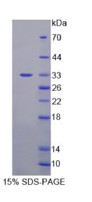 锌指同源框蛋白1B(ZFHX1B)重组蛋白