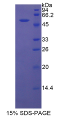 乳腺癌易感蛋白1(BRCA1)重组蛋白