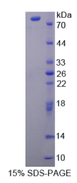 肉毒碱棕榈酰基转移酶2(CPT2)重组蛋白