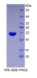 普列克底物蛋白同源物样域家族A成员2(PHLDA2)重组蛋白