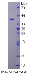 醛脱氢酶1家族成员A1(ALDH1A1)重组蛋白
