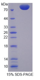 前蛋白转化酶枯草溶菌素9(PCSK9)重组蛋白