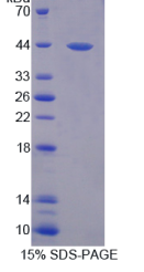 环指蛋白55(RNF55)重组蛋白