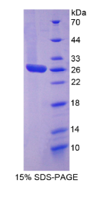 信号传导转录激活因子3(STAT3)重组蛋白