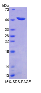 信号转导衔接分子2(STAM2)重组蛋白