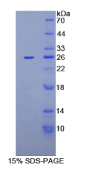 趋化因子C-X-C-基元配体16(CXCL16)重组蛋白