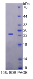 视黄醇结合蛋白5(RBP5)重组蛋白