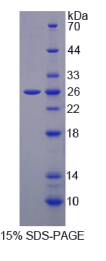 溶质载体家族30成员6(SLC30A6)重组蛋白