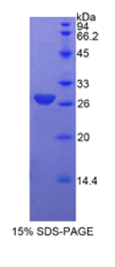 平滑肌肌动蛋白α2(ACTα2)重组蛋白