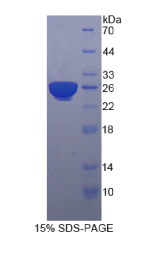 妊娠特异性β1-糖蛋白(PSG1)重组蛋白